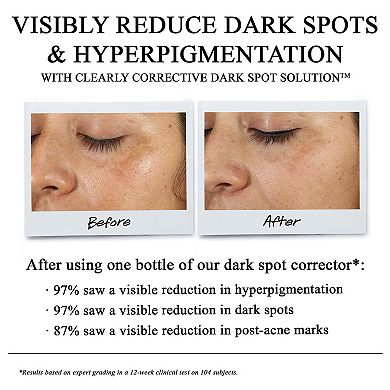 Clearly Corrective Dark Spot Correcting Serum