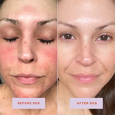 Mini SOS Daily Rescue Facial Spray with Hypochlorous Acid