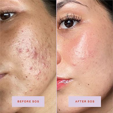 Mini SOS Daily Rescue Facial Spray with Hypochlorous Acid