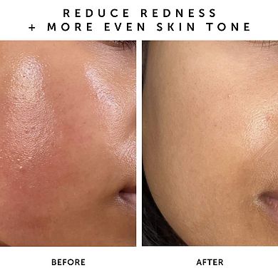 Mini Nova 15% Vitamin C + Turmeric Brightening Serum