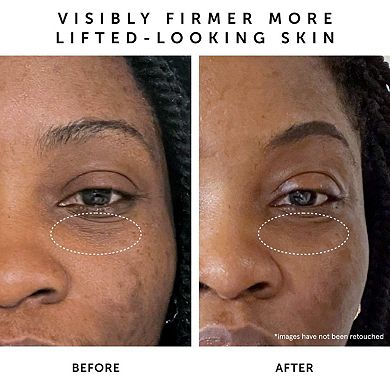 Moon Fruit 1% Bakuchiol + Peptides Retinol Alternative Serum