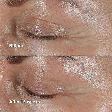 Smart Clinical Repair Wrinkle Correcting Eye Cream