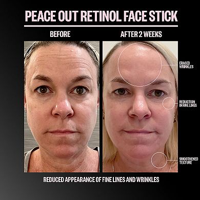 Retinol Face Stick