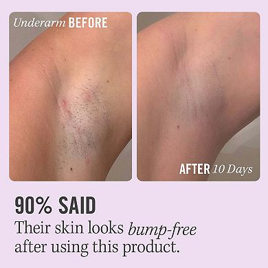 Ingrown Hair Pads with BHA & AHA