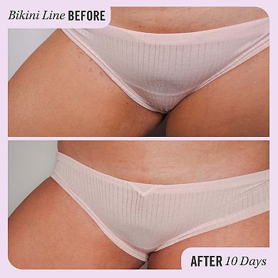 Ingrown Hair Pads with BHA & AHA