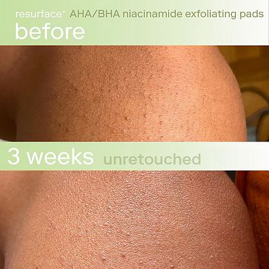 Resurface+ AHA/BHA Niacinamide Exfoliating Pads for Face and Targeted Body