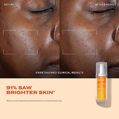 Rapid Dark Spot Correcting Serum with Glycolic and Tranexamic Acid