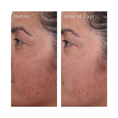 Rapid Dark Spot Correcting Serum