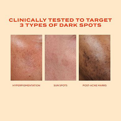 Rapid Dark Spot Correcting Serum with Glycolic and Tranexamic Acid