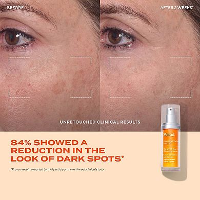 Rapid Dark Spot Correcting Serum with Glycolic and Tranexamic Acid