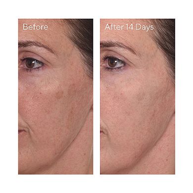 Rapid Dark Spot Correcting Serum with Glycolic and Tranexamic Acid