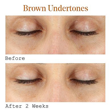 Vitamin C Dark Circle Correcting Eye Serum