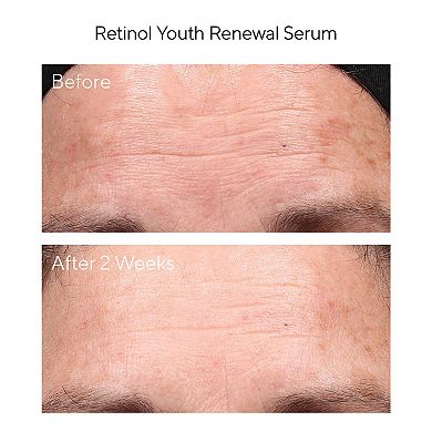 Youth Renewal Retinol Trial Kit for Smoother, Younger-Looking Skin