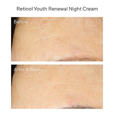 Youth Renewal Retinol Trial Kit for Smoother, Younger-Looking Skin