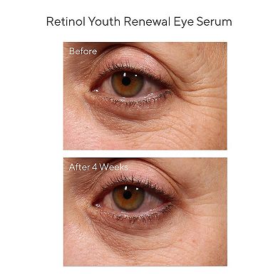 Youth Renewal Retinol Trial Kit for Smoother, Younger-Looking Skin