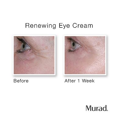 Renewing Eye Cream