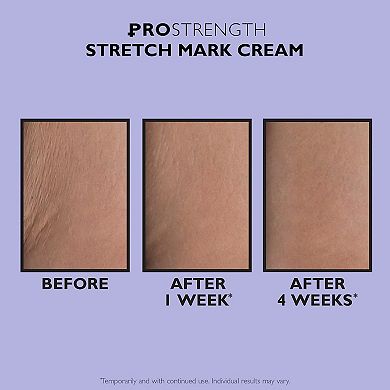 PRO Strength Stretch Mark Cream