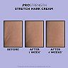 PRO Strength Stretch Mark Cream