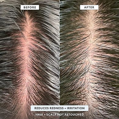 Scalp Revival Dandruff Relief Charcoal Shampoo
