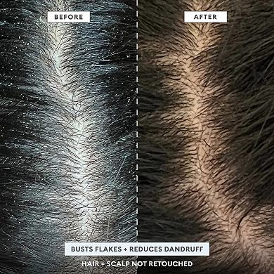 Scalp Revival Dandruff Relief Charcoal Shampoo