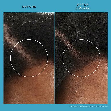 Scalp Care Revitalizing Treatment