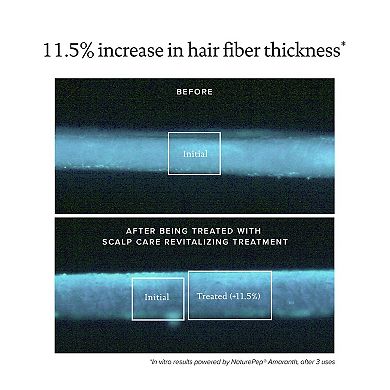 Scalp Care Revitalizing Treatment