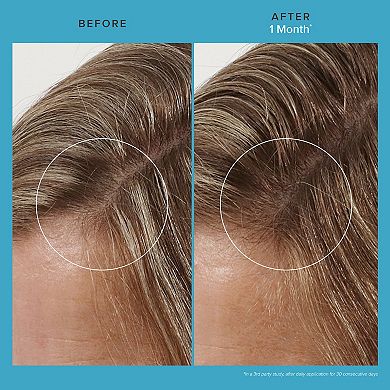 Scalp Care Revitalizing Treatment