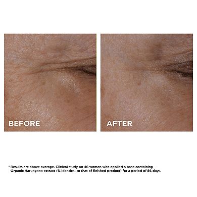 Total Eye Lift Firming & Smoothing Anti-Aging Eye Cream