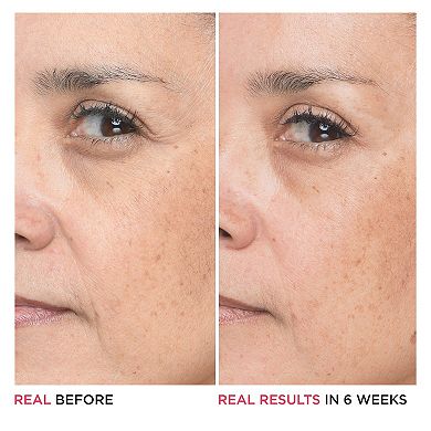 Bye Bye Lines 1.5% Hyaluronic Acid Serum