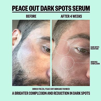 Dark Spots Serum