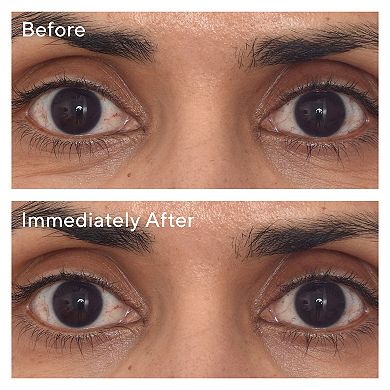 Retinol Youth Renewal Eye Masks
