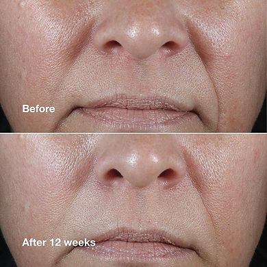 Smart Clinical Repair Wrinkle Correcting Anti-Aging Rich Cream with Peptides
