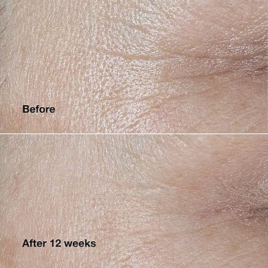 Smart Clinical Repair Wrinkle Correcting Anti-Aging Cream with Peptides