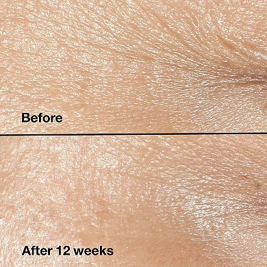 Smart Clinical Repair Wrinkle Correcting Anti-Aging Cream with Peptides