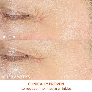 Vitamin C Lactic Firm & Bright Eye Treatment