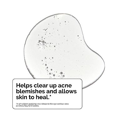 Salicylic Acid 2% Exfoliating Blemish Solution