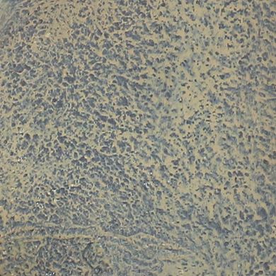 Sunnydaze Rosette Leaf Polystone Outdoor Solar Wall Fountain