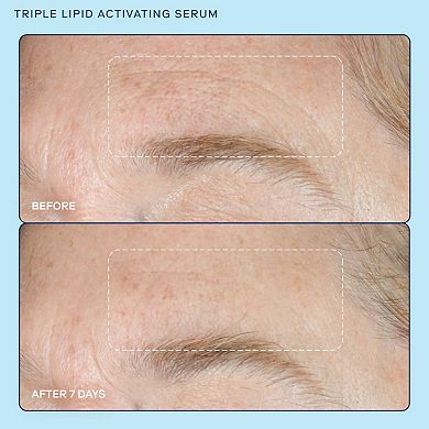 barrier+ Triple Lipid + Niacinamide Activating Serum