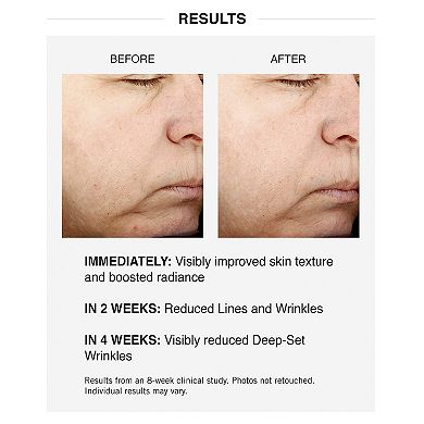 Powerful-Strength Vitamin C Serum for Glow & Fine Lines