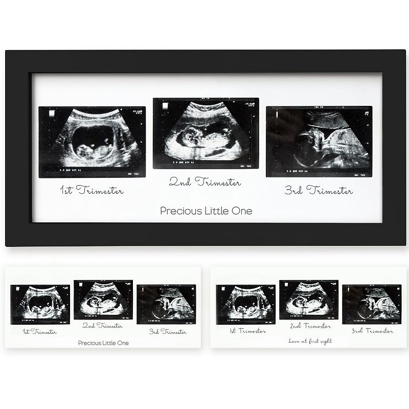 New Mom Gifts Baby Ultrasound Picture Frame Sonogram Keepsake Frame,  Christmas Pregnancy Gifts for First Time Mom Dad, Pregnancy Announcements  Gender Reveal Baby Shower Gifts Nursery Decor-4x6 Photo