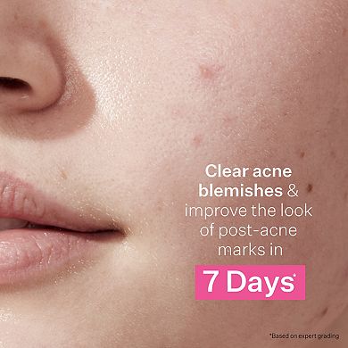 Multi Action Clear Acne Control 30-Day Trial Kit