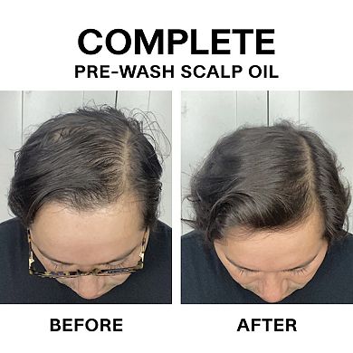 Complete Pre-Wash Scalp & Hair Strengthening Treatment Oil