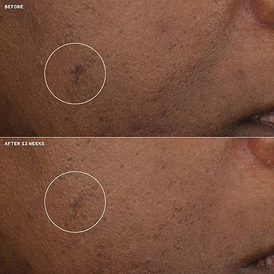 Even Better Clinical Brightening Moisturizer with Vitamin C
