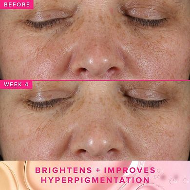 Brighten Up 3% TXA Dark Spot Toner with Azelaic Acid