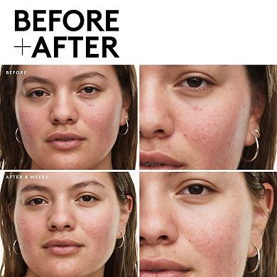 Fenty Skin Travel-Size Start'r Set: Dry Skin Edition