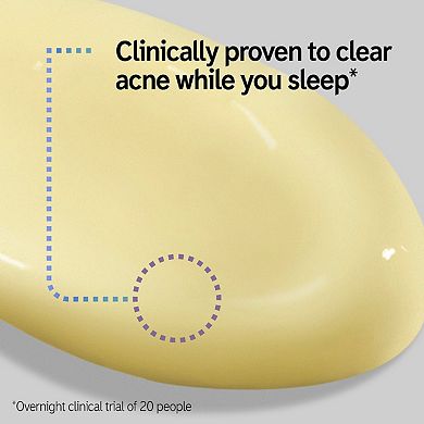 SuperSolutions Acne Clearing Moisturizer 2% NOVORETINTM