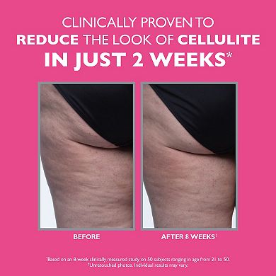 FIRMx Tight & Toned Cellulite Treatment