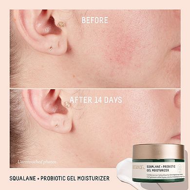 Squalane + Probiotic Balancing Gel Moisturizer