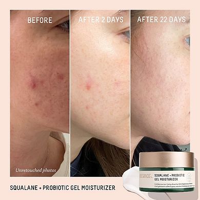 Probiotic Balancing Gel Moisturizer + Squalane