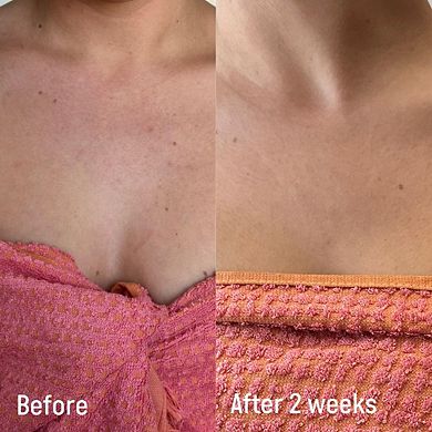 Confidently Clear Body Moisturizer with Lactic & Hyaluronic Acids